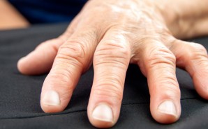 6 Natural Rheumatoid Arthritis Treatments for Flare-Ups