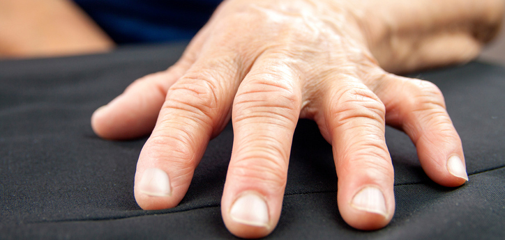 Rheumatoid Arthritis Treatments, rheumatoid arthritis treatment