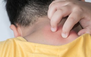 allergy treatment, allergy symptoms, natural allergy treatment