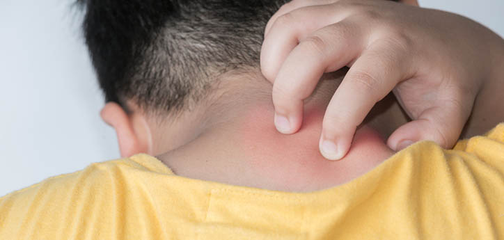 allergy treatment, allergy symptoms, natural allergy treatment