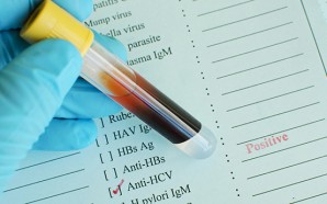 Hepatitis C, Hepatitis C Facts