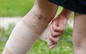 deep vein thrombosis prophylaxis