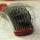 Get the Ultimate Hair Loss Treatment for Your Hair, hair loss, hair loss treatment