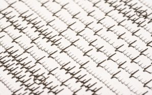 afib apixaban medications
