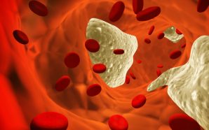 cholesterol medications not statins