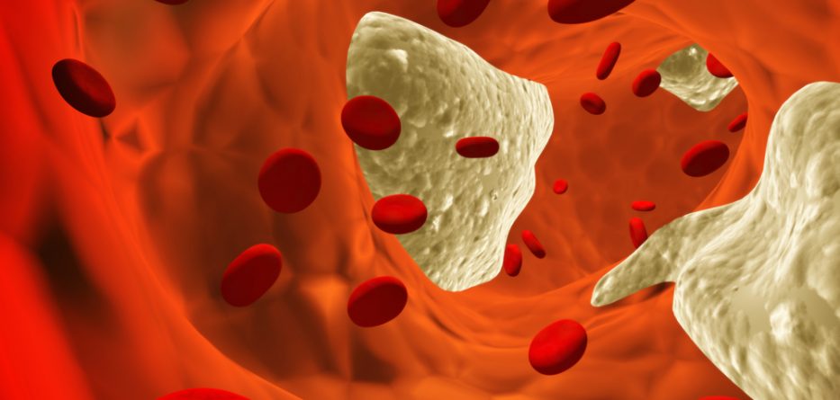 cholesterol medications not statins