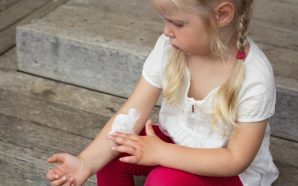 Eczema Creams
