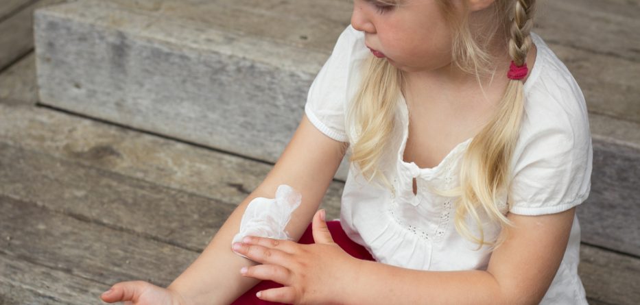 Eczema Creams