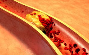 LIVALO lowering ldl cholesterol