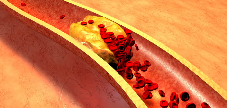 LIVALO lowering ldl cholesterol