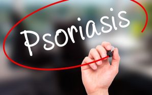 Ixekizumab Plaque Psoriasis Treatment