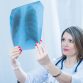 advanced nsclc treatments