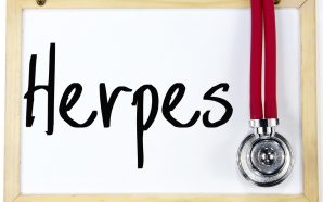 herpes test